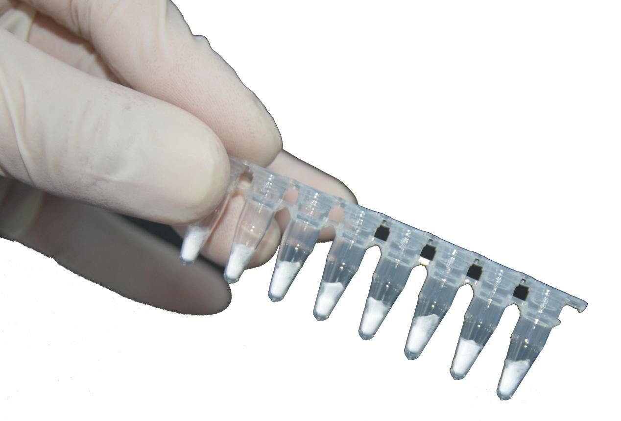 Gloved hand holding an eight-well RAA reaction strip